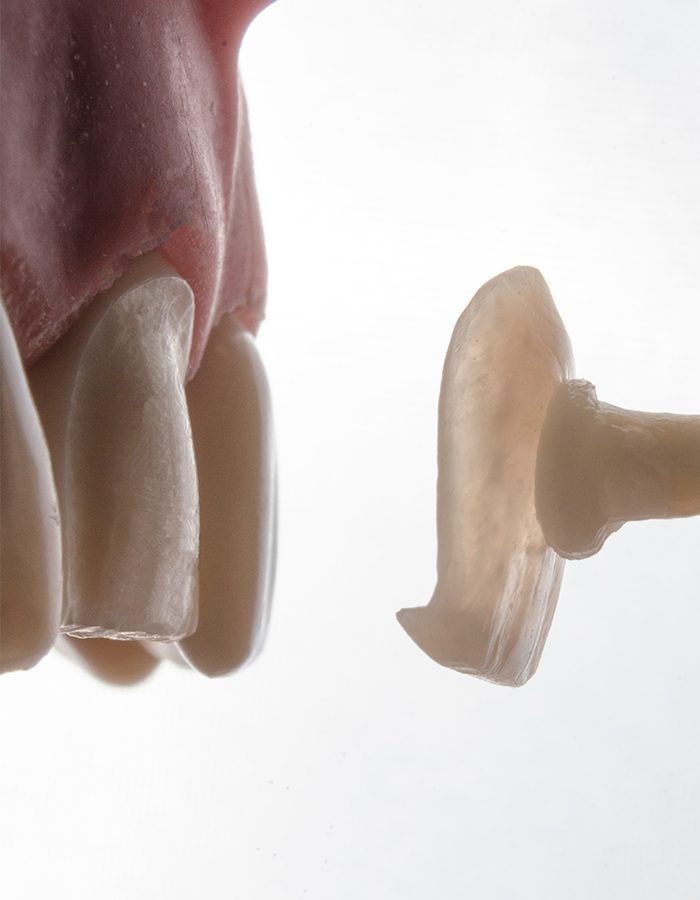 behandeling-bij-de-tandarts-zoetermeer-3